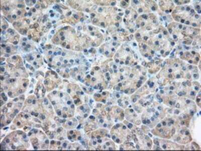 Immunohistochemistry: Rab17 Antibody (OTI5E2) - Azide and BSA Free [NBP2-73765]