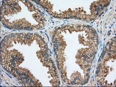 Immunohistochemistry: Rab17 Antibody (OTI5E2) - Azide and BSA Free [NBP2-73765]