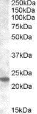 Western Blot: Rab17 Antibody [NBP1-00132]