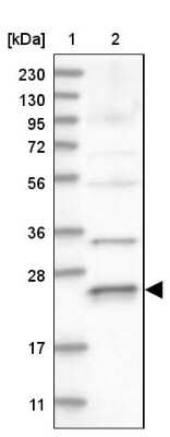 Western Blot: Rab17 Antibody [NBP1-85910]