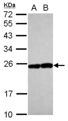 Western Blot: Rab17 Antibody [NBP2-20036]