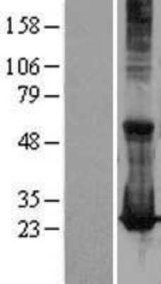 Western Blot: Rab17 Overexpression Lysate [NBL1-15043]