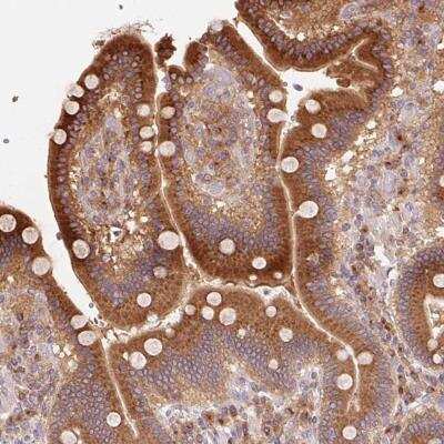 Immunohistochemistry: Rab1A Antibody [NBP2-46830]