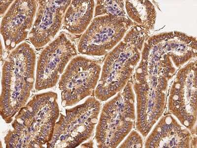 Immunohistochemistry-Paraffin: Rab1A Antibody [NBP2-99499]