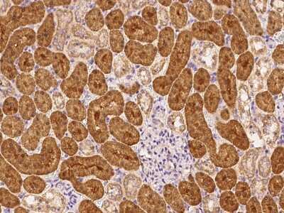 Immunohistochemistry-Paraffin: Rab1A Antibody [NBP2-99499]