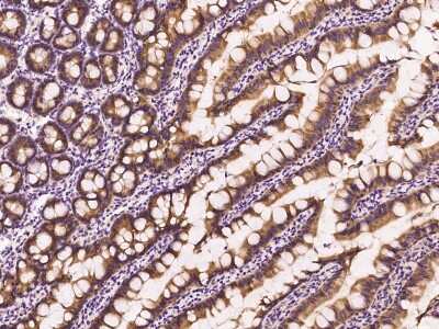 Immunohistochemistry-Paraffin: Rab1A Antibody [NBP2-99499]