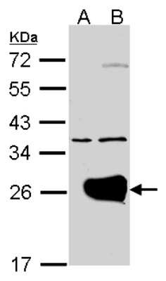 Western Blot: Rab1A Antibody [NBP2-20037]