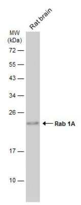 Western Blot: Rab1A Antibody [NBP2-20037]