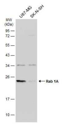 Western Blot: Rab1A Antibody [NBP2-20037]