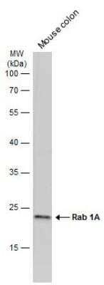 Western Blot: Rab1A Antibody [NBP2-20037]