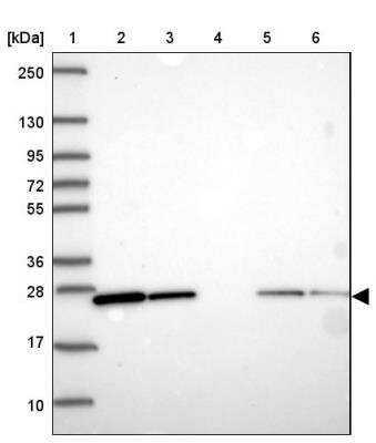 Western Blot: Rab1A Antibody [NBP2-46830]