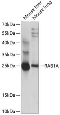 Western Blot: Rab1A AntibodyAzide and BSA Free [NBP2-93640]