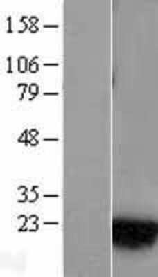 Western Blot: Rab1A Overexpression Lysate [NBL1-15045]