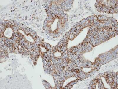 Immunohistochemistry-Paraffin: Rab2 Antibody [NBP1-31480]