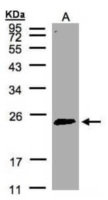 Western Blot: Rab2 Antibody [NBP1-31480]