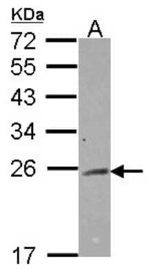 Western Blot: Rab2 Antibody [NBP2-20038]