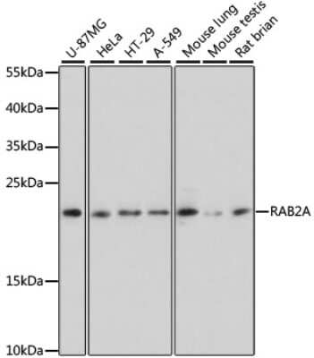 Western Blot: Rab2 AntibodyAzide and BSA Free [NBP2-94508]