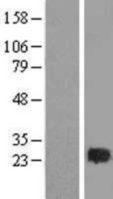 Western Blot: Rab2 Overexpression Lysate [NBL1-15057]