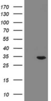 Western Blot: Rab20 Antibody (OTI1F1) [NBP2-45924]