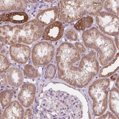 Immunohistochemistry: Rab20 Antibody [NBP2-39096]