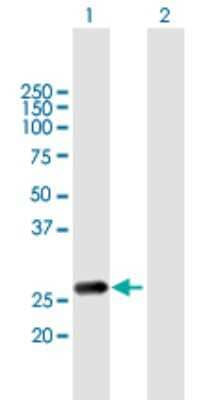 Western Blot: Rab20 Antibody [H00055647-B01P]