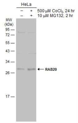 Western Blot: Rab20 Antibody [NBP2-20039]