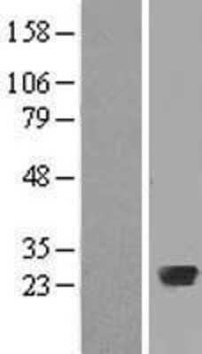 Western Blot: Rab20 Overexpression Lysate [NBL1-15046]