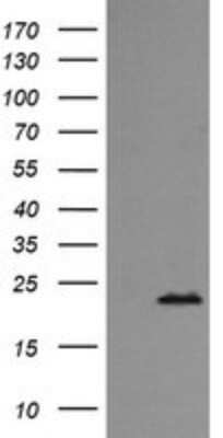 Western Blot: Rab24 Antibody (OTI3H1)Azide and BSA Free [NBP2-73770]