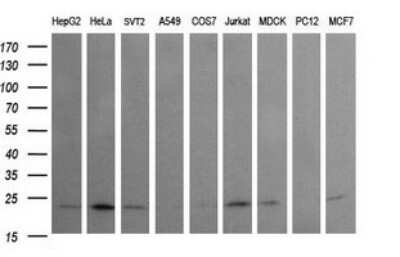 Western Blot: Rab24 Antibody (OTI3H1) [NBP2-45925]