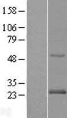 Western Blot: Rab24 Overexpression Lysate [NBL1-15051]