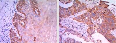 Immunohistochemistry-Paraffin: Rab25 Antibody (3F12) - BSA Free [NBP1-51599]