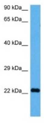 Western Blot: Rab25 Antibody [NBP3-10035]