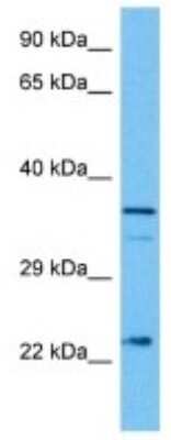 Western Blot: Rab25 Antibody [NBP3-10069]