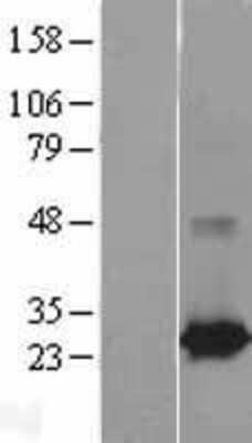 Western Blot: Rab25 Overexpression Lysate [NBL1-15053]