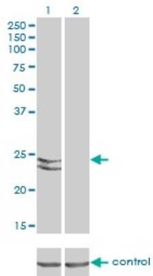 Western Blot: Rab27a Antibody (1G7) [H00005873-M02]