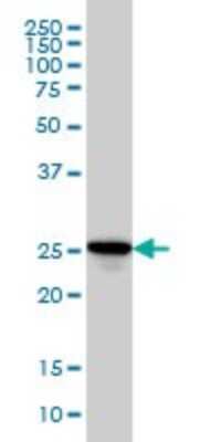 Western Blot: Rab27a Antibody (1G7) [H00005873-M02]