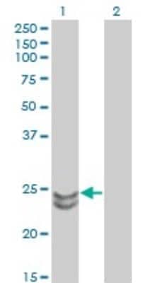 Western Blot: Rab27a Antibody (1G7) [H00005873-M02]