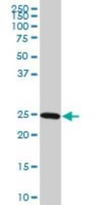 Western Blot: Rab27a Antibody (4C1) [H00005873-M01]