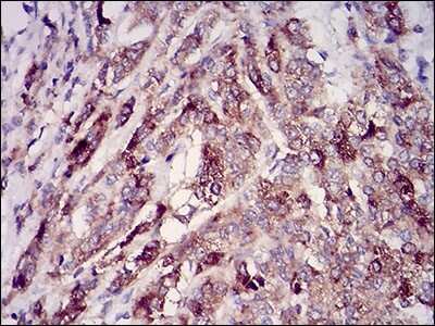 Immunohistochemistry-Paraffin: Rab27a Antibody (7D7C9) - BSA Free [NBP2-37248]