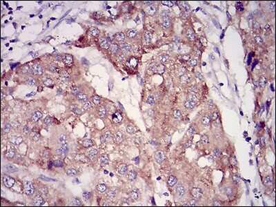 Immunohistochemistry-Paraffin: Rab27a Antibody (7D7C9) - BSA Free [NBP2-37248]