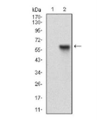 Western Blot: Rab27a Antibody (7D7C9)BSA Free [NBP2-37248]