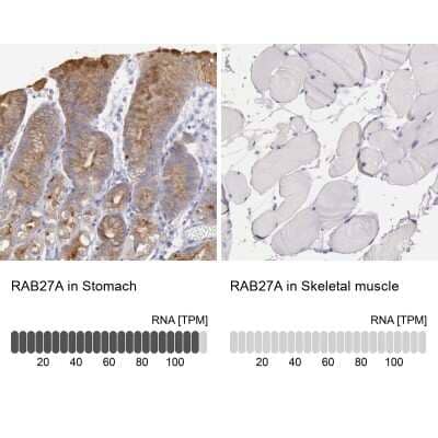 Immunohistochemistry-Paraffin: Rab27a Antibody [NBP1-83327]