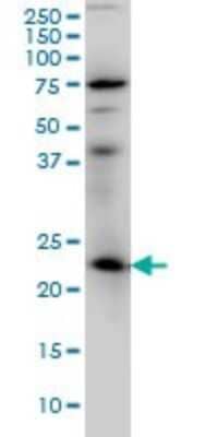 Western Blot: Rab3A Antibody (4H7) [H00005864-M01]