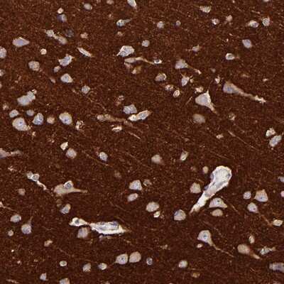 Immunohistochemistry-Paraffin: Rab3A Antibody [NBP1-89470]