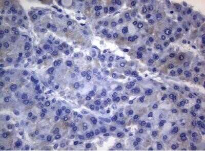 Immunohistochemistry: Rab3A Antibody (OTI1G3) - Azide and BSA Free [NBP2-73773]