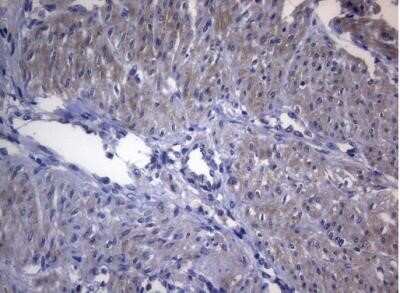 Immunohistochemistry: Rab3A Antibody (OTI1G3) - Azide and BSA Free [NBP2-73773]