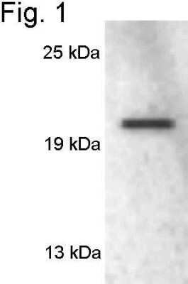 Western Blot: Rab3A Antibody [NB120-3335]