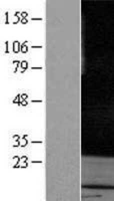 Western Blot: Rab3A Overexpression Lysate [NBP2-08067]