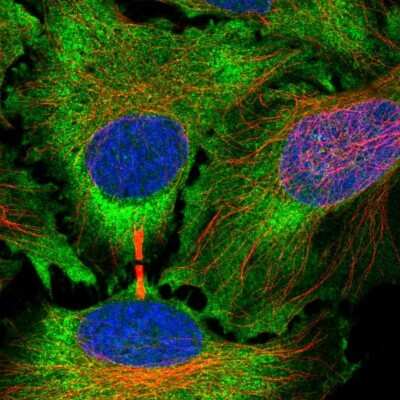 Immunocytochemistry/ Immunofluorescence: Rab3C Antibody [NBP2-55288]