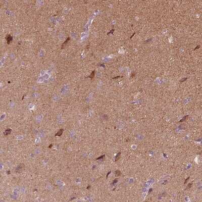 Immunohistochemistry-Paraffin: Rab3C Antibody [NBP2-55288]